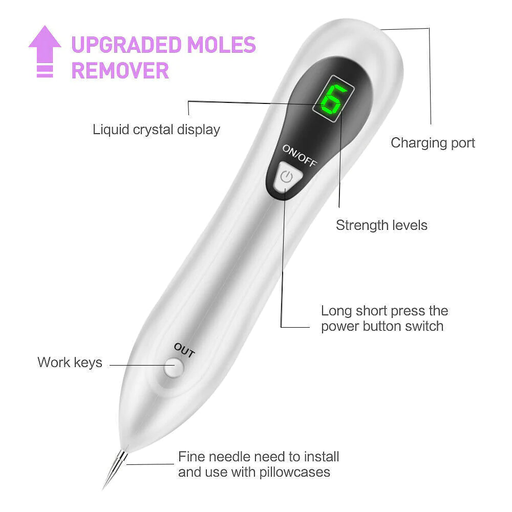 Electric Laser Plasma Pen Removes Moles
