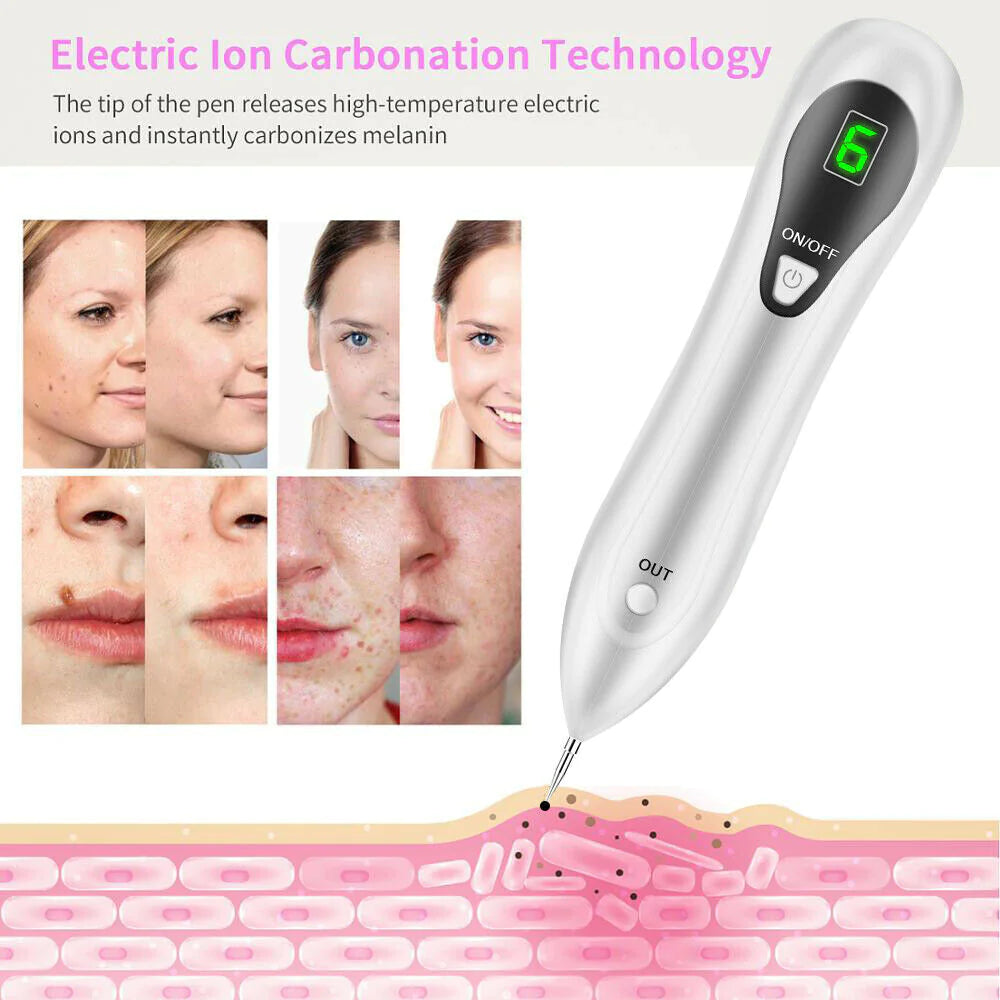 Electric Laser Plasma Pen Removes Moles