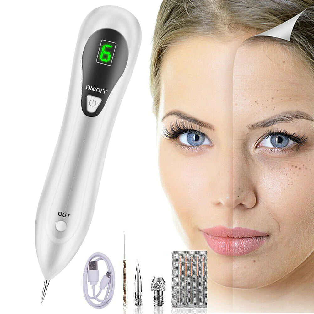 Electric Laser Plasma Pen Removes Moles