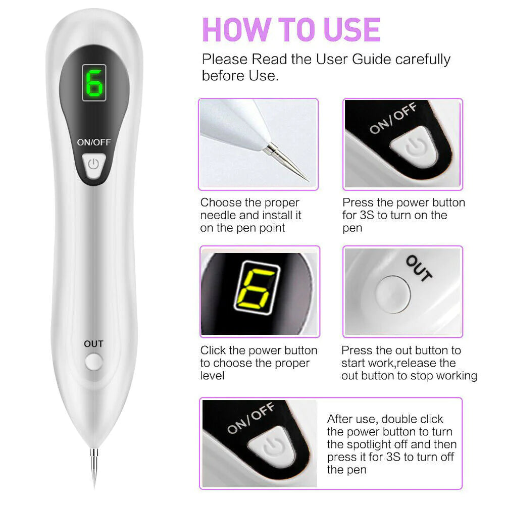 Electric Laser Plasma Pen Removes Moles