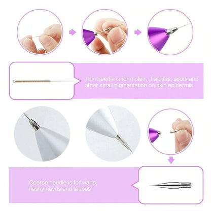 Electric Laser Plasma Pen Removes Moles